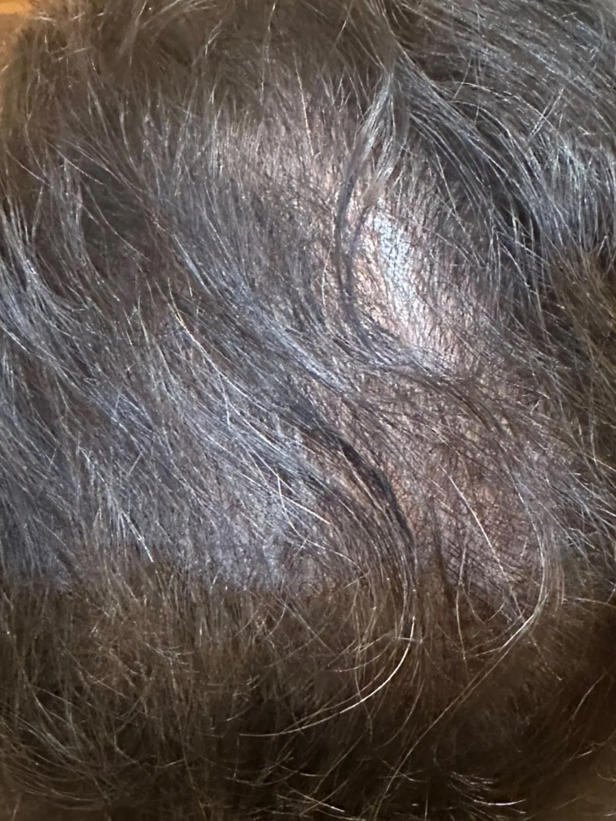 Fuller Hair Density, before and after