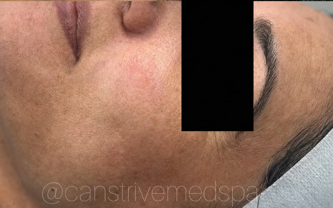 Uneven Tone Brightened, before and after
