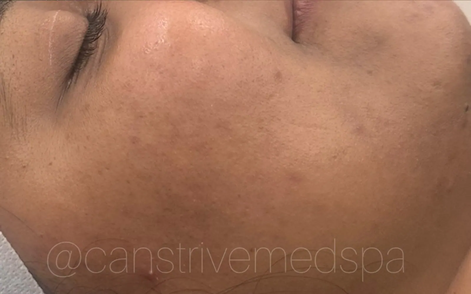 Brighter, More Even Skin, before and after