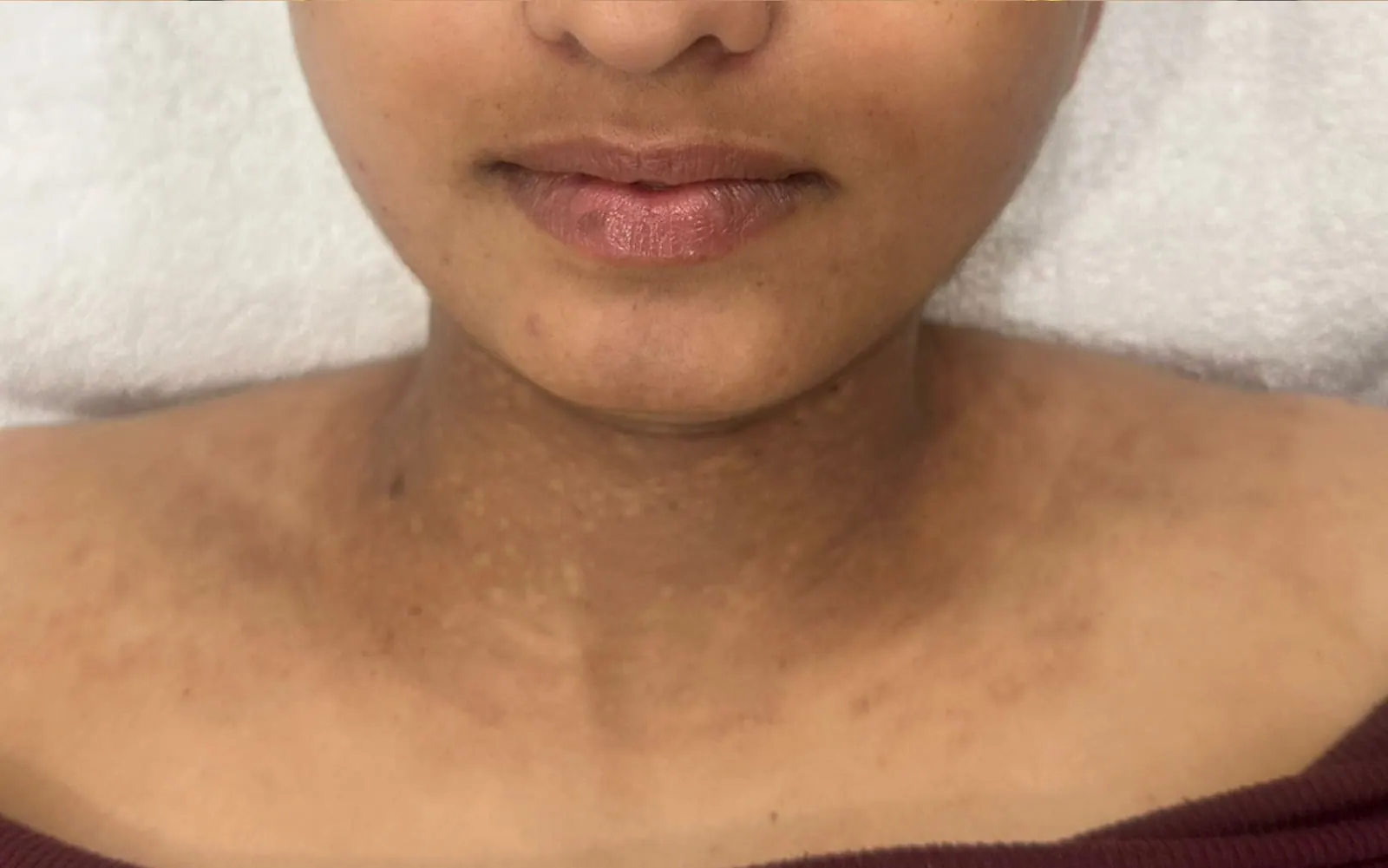 Neck Darkening Lightened, before and after