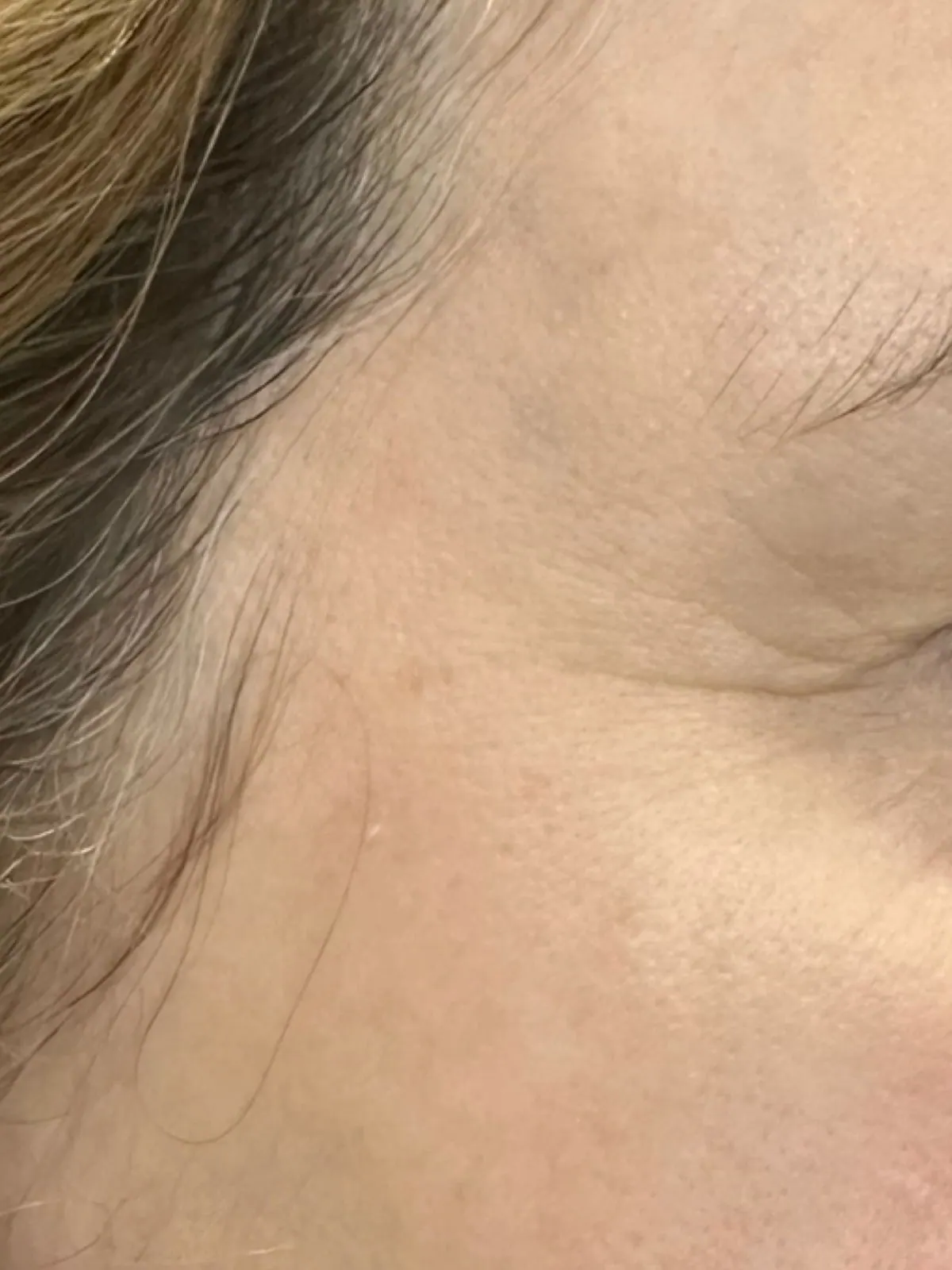 Fine Lines Softened, before and after